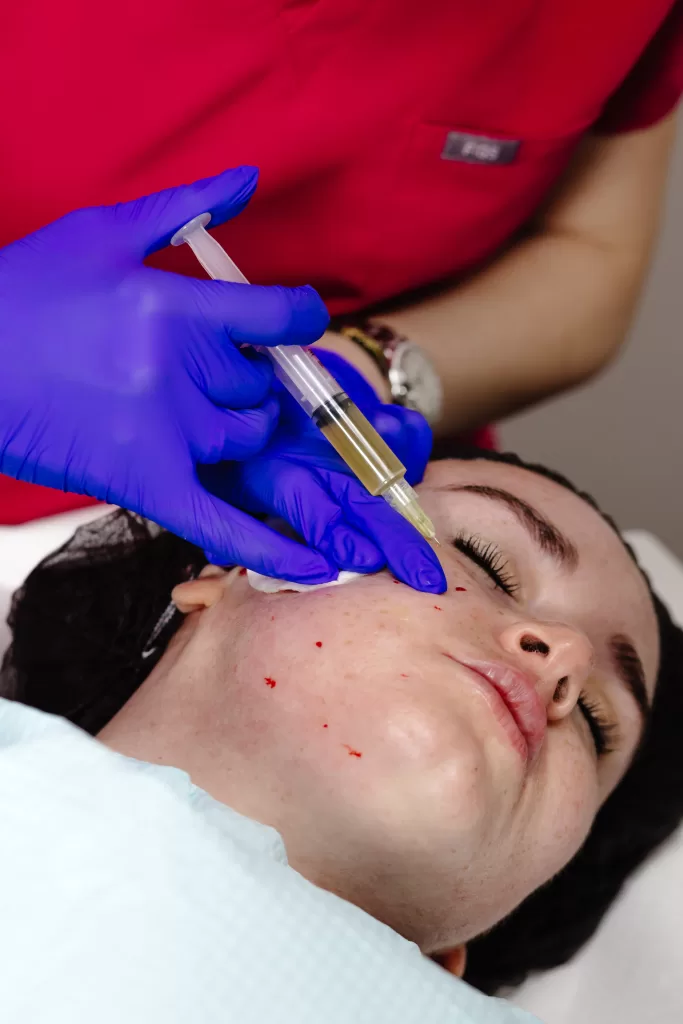 PRP Treatment - Laccura