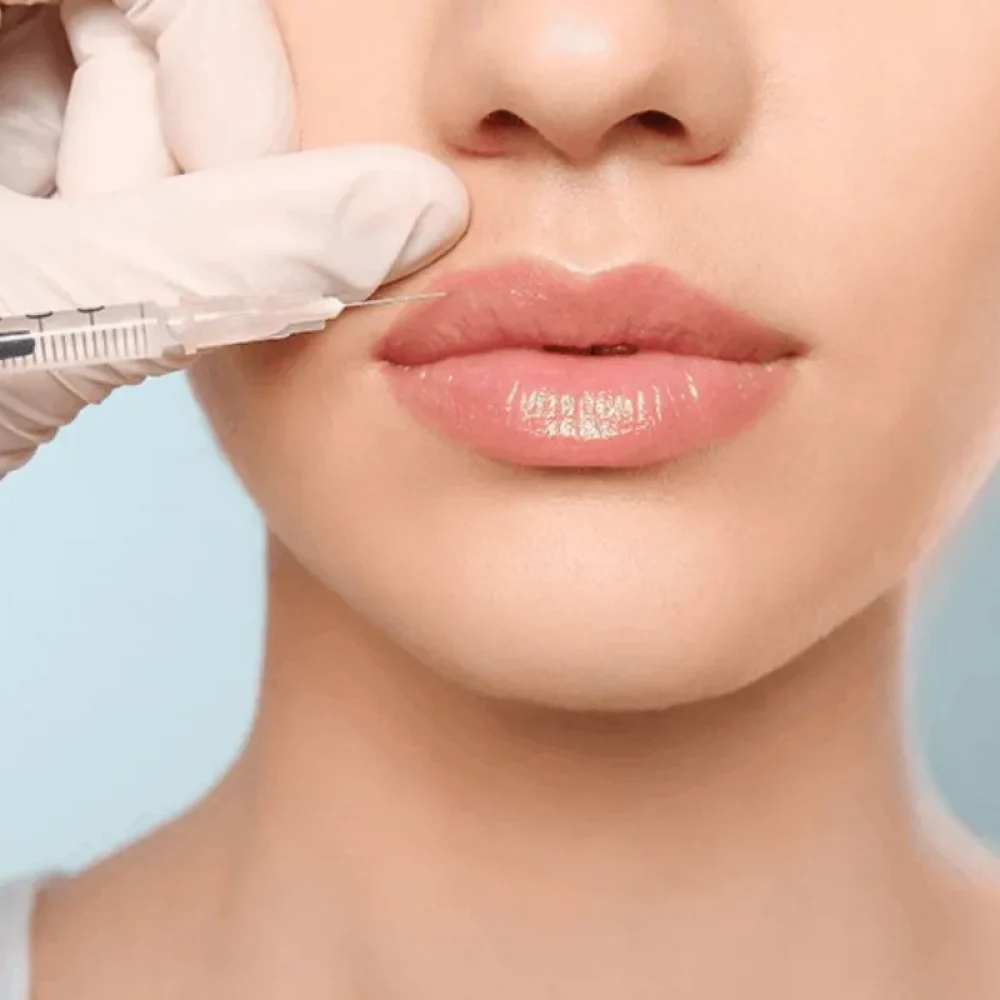 Filler Dissolving - Lacurra-Med
